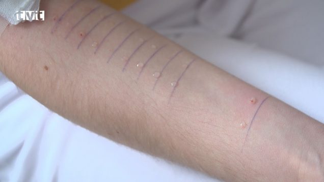 Alergici si niekedy vyslúžia nepríjemné pohľady