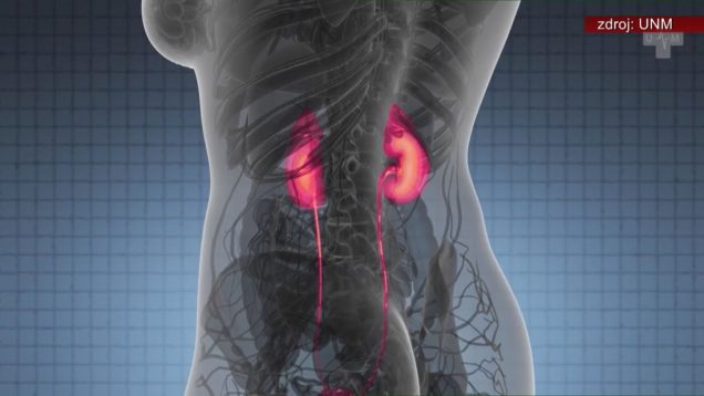 <strong><u>Na Slovensku trpí 80-tisíc pacientov chronickou chorobou obličiek. Keďže obličky nebolia, mnoho ľudí o svojom ochorení nevie</u></strong>