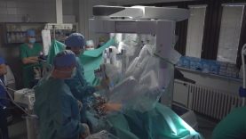 Lekári v UNM operovali doposiaľ robotickým systémom najnovšej generácie len dospelých pacientov. Do budúcna je v pláne využívať ho pri detských pacientoch