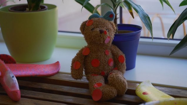 Tajomná psoriáza, Nie je nákazlivá, ale je nepríjemná. Pacientov pribúda, nenechávajme ich v tom samých